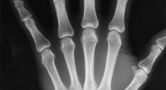 10_facts_x-ray_2_576